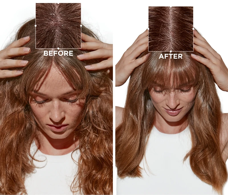 Kérastase Symbiose Masque Revitalisant Essentiel – Image 5